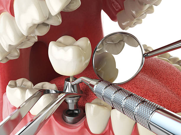 Best Emergency Denture Repair in Tulare, CA